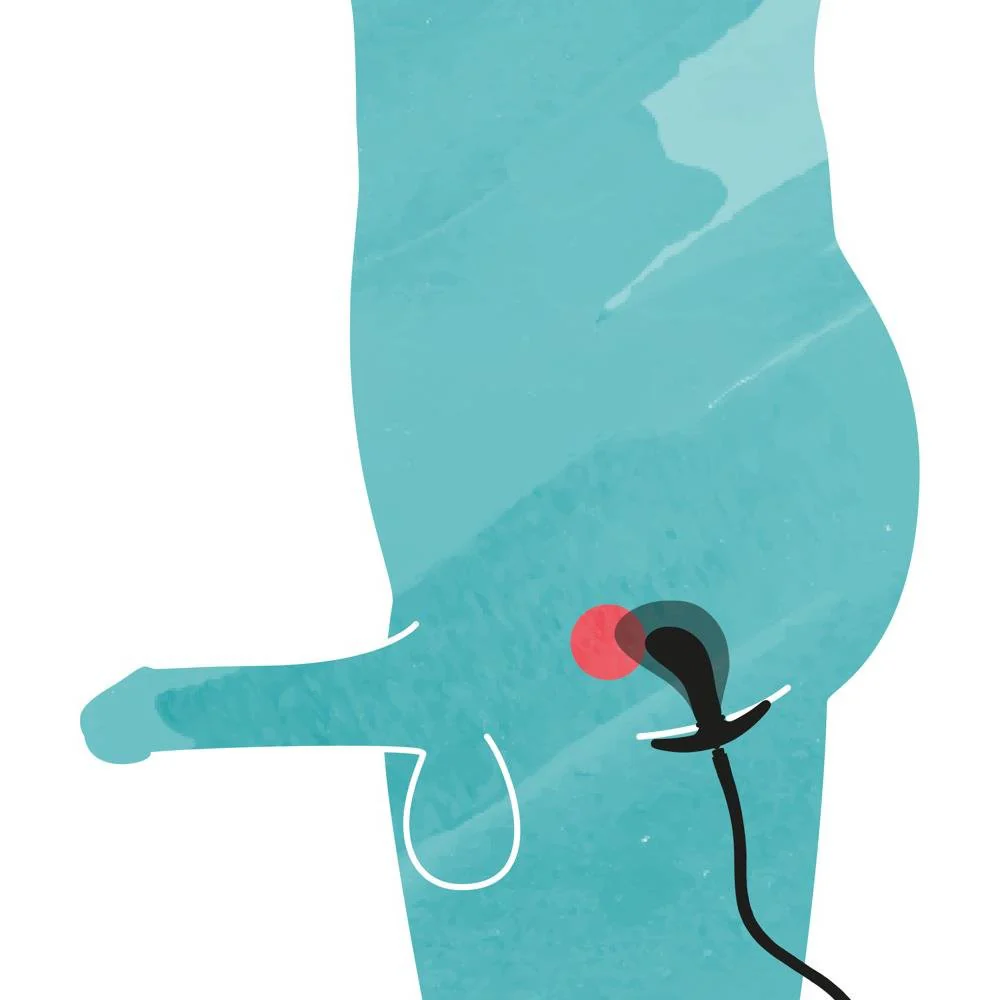 Inflatable Butt Plug + Removable Tube - Image 8